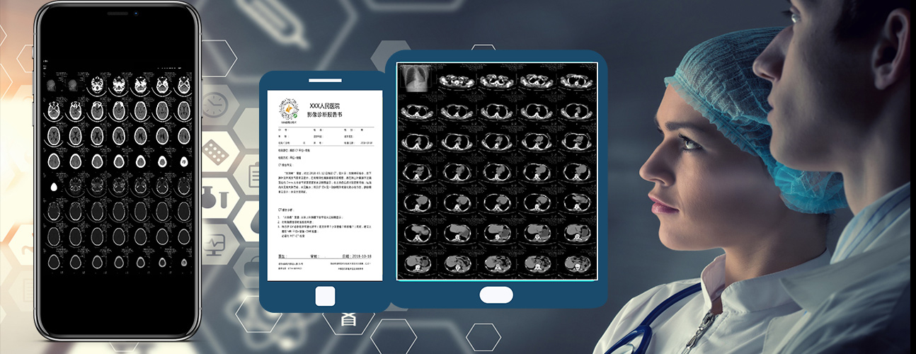 醫院放射透視檢測報告電子膠片檢查報告云管理系統軟件開發APP小程序定制